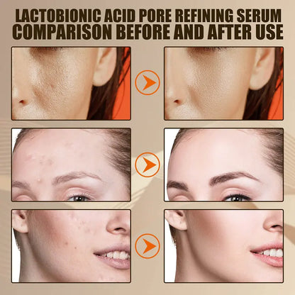 Bravita™ Pores Minimising Serum
